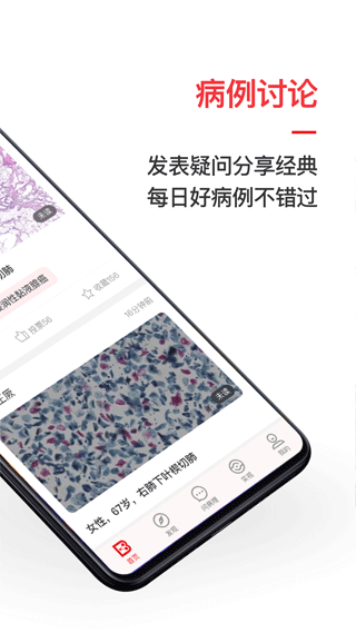 爱病理图2
