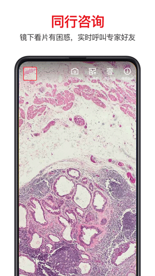 爱病理图5