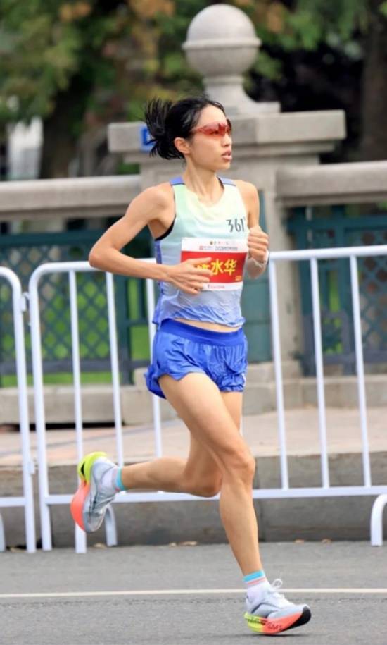 “悉尼妹”亲口承认未整容、无纹身，曾因脸部受伤缝了19针