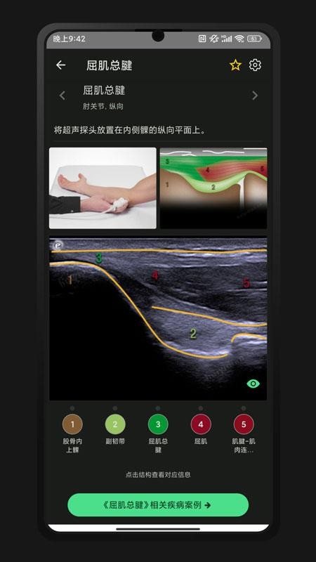 超声智学图4