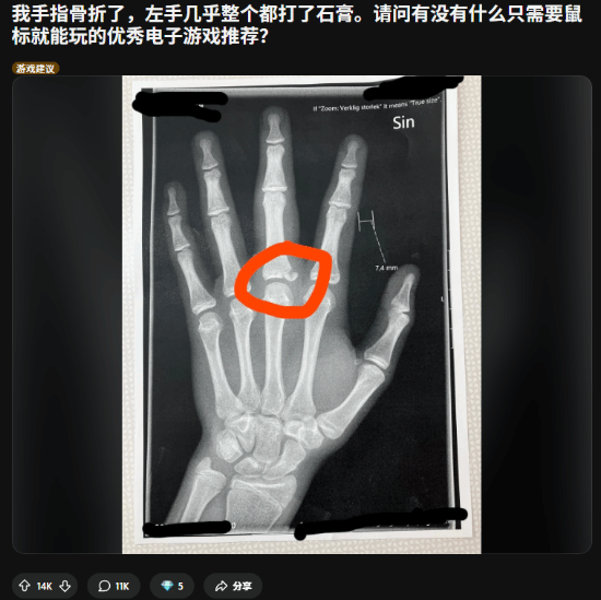 紧急求助！玩家左手骨折后想知道有哪些游戏可以“单手”游玩？