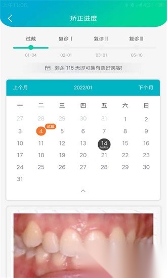 青椒美牙