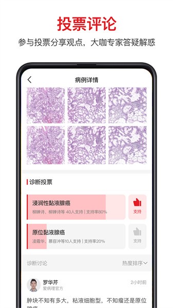 爱病理软件