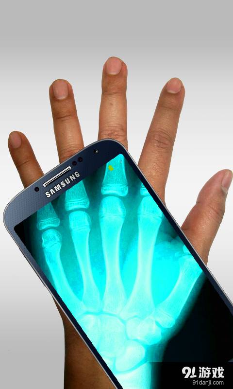 Xray Scanner免费原版图5