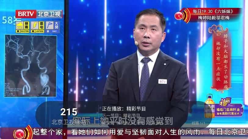环边直播图4