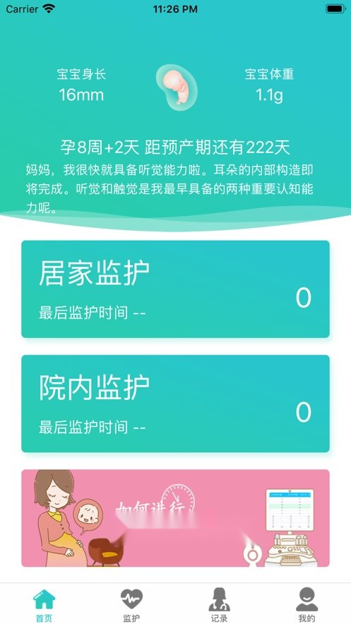 胎心监护