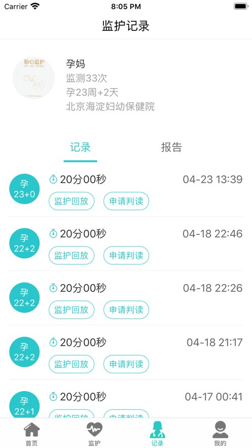 胎心监护
