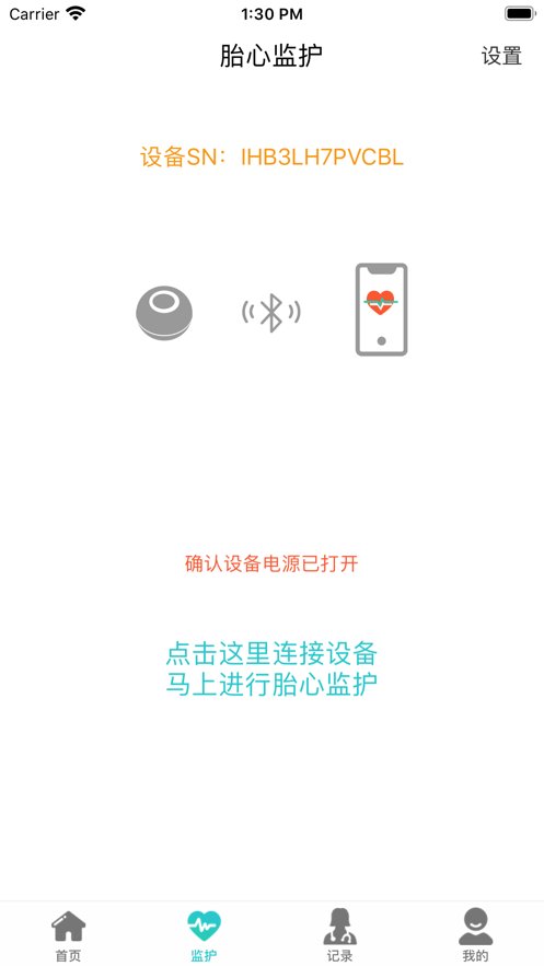 胎心监护
