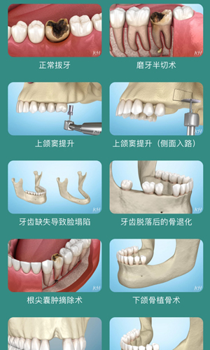 口腔图谱安卓免费版图5