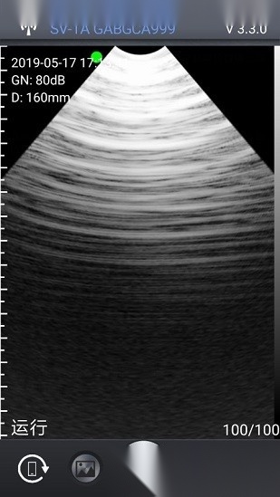 智能B超app手机版