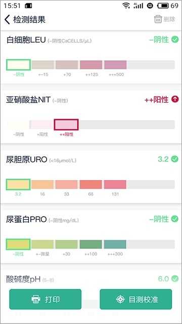 U10 SnapEasy图2