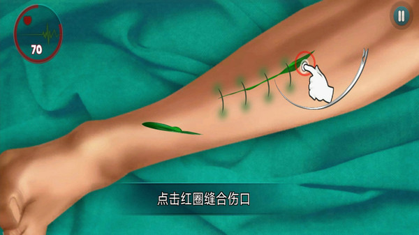 外科医生挑战游戏