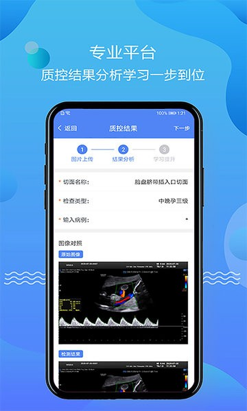 超声智库免费原版图2