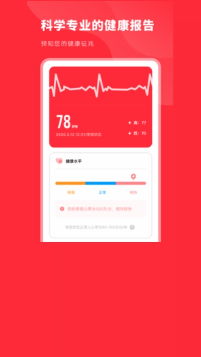 口袋心电图免费原版图2