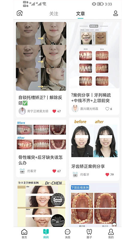 尚牙圈无广告版图3