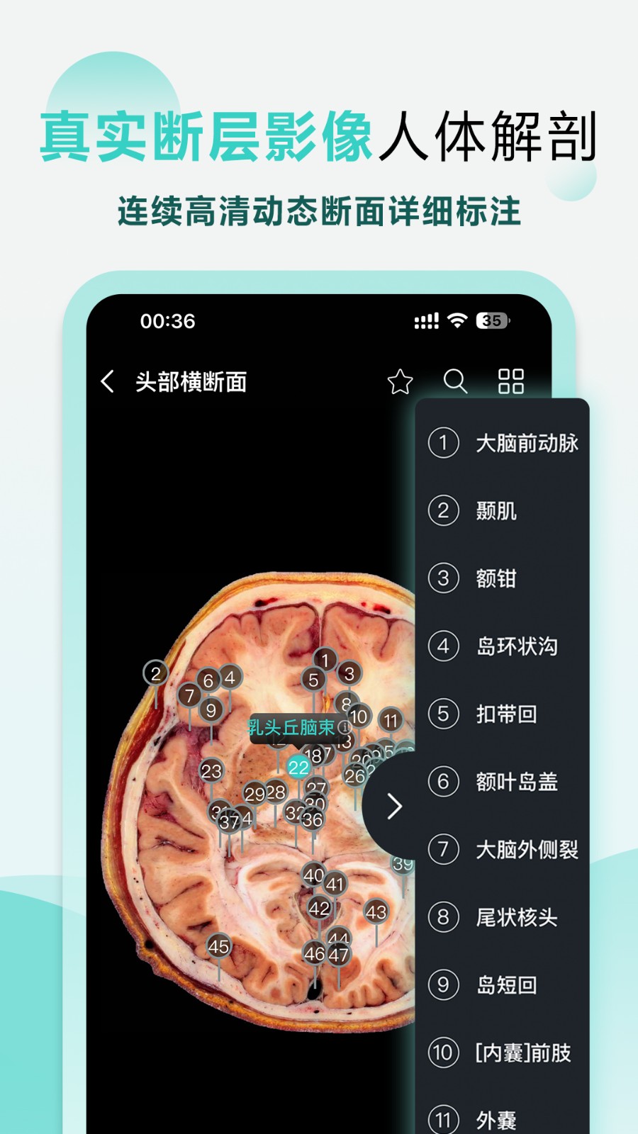 掌上3D解剖手机最新版