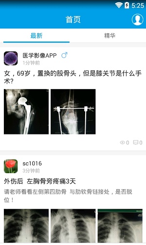 医学影像官方最新版图1