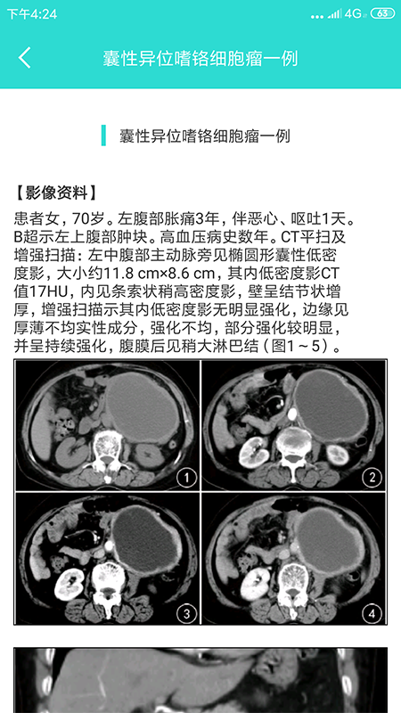 影像图鉴通用版图4