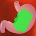 放屁救援(Fart Relief)手游版