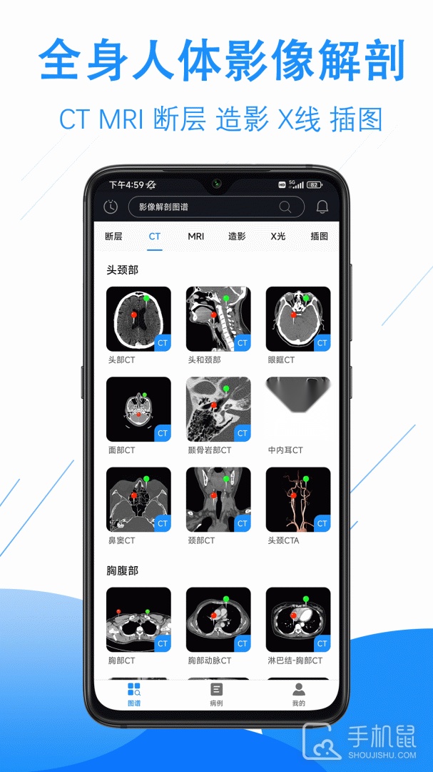 影像解剖图谱(1)