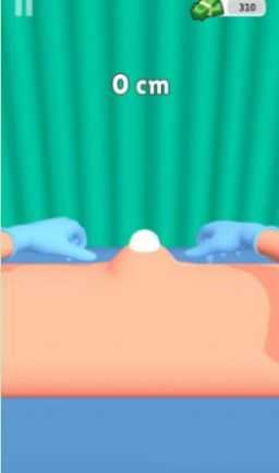 挤疙瘩挑战(Pimple Squeeze)图2