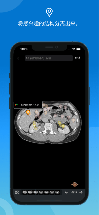 eAnatomy最新版图3