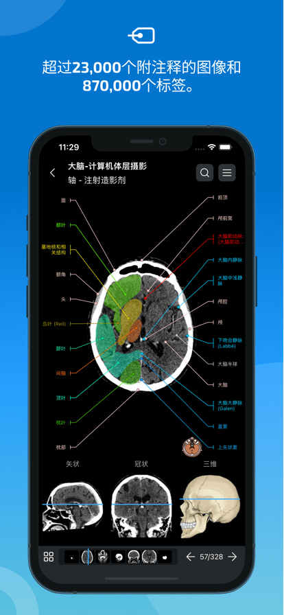 eAnatomy最新版图4